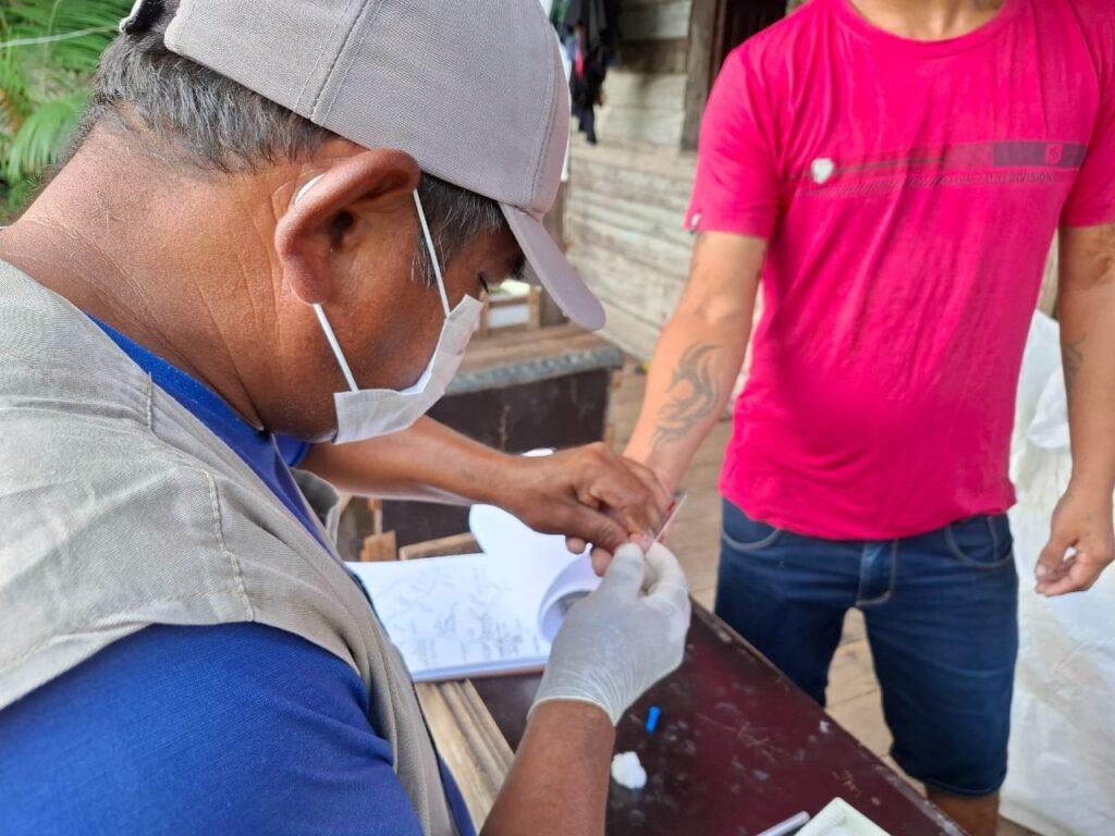 Santana reduz casos de Malária em 88% e registra apenas um caso em 2025