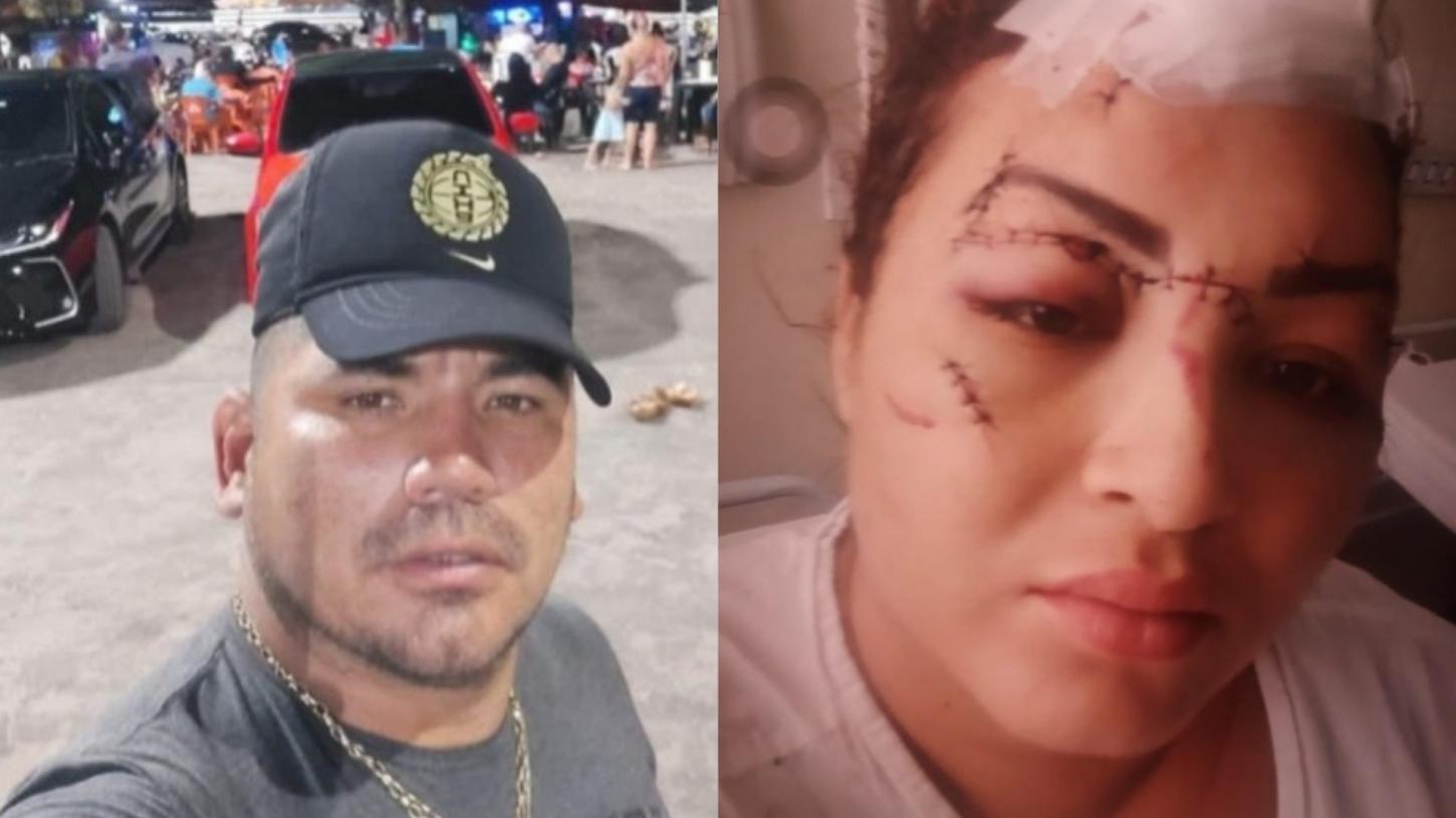 Em Santana: homem que esfaqueou ex-mulher mais de 30 vezes se entrega à polícia