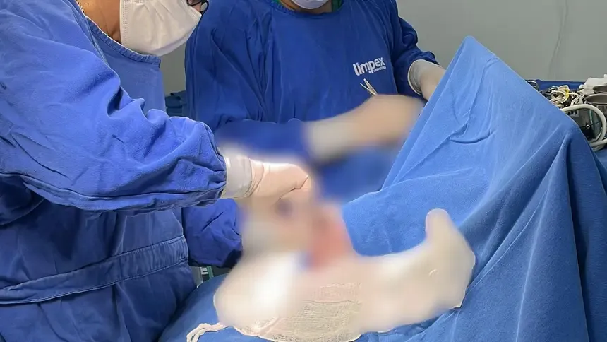 Esperança na UTI: bebê de 6 meses é operado em procedimento inédito no Amapá