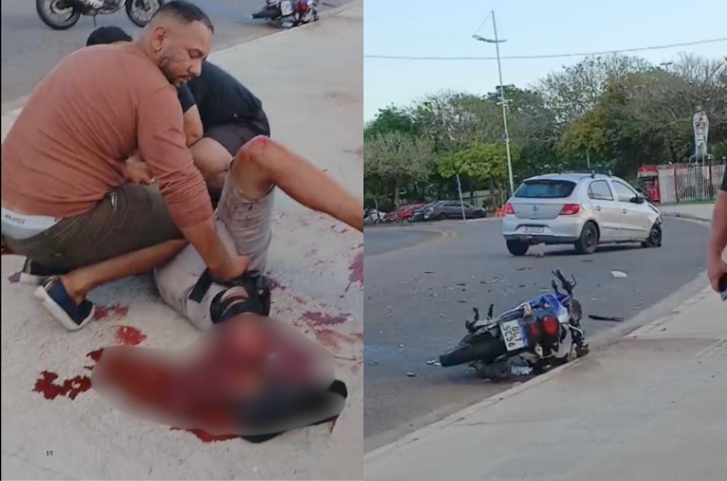 Acidente grave deixa motociclista ferido na orla de Macapá; veja o vídeo